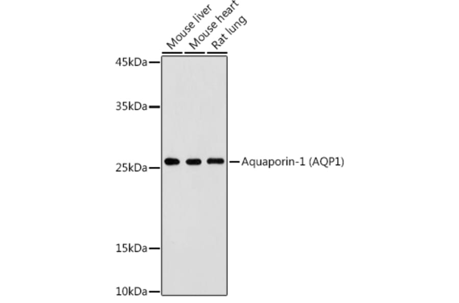 Western Blot - Anti-Aquaporin 1 Antibody (A89041) - Antibodies.com
