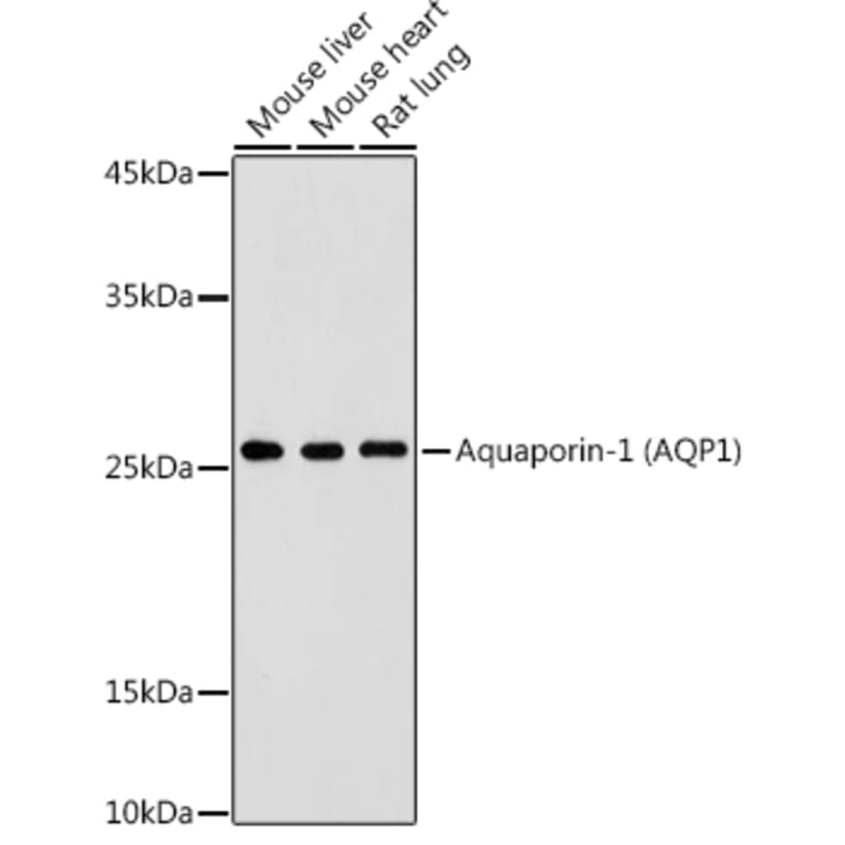 Western Blot - Anti-Aquaporin 1 Antibody (A89041) - Antibodies.com