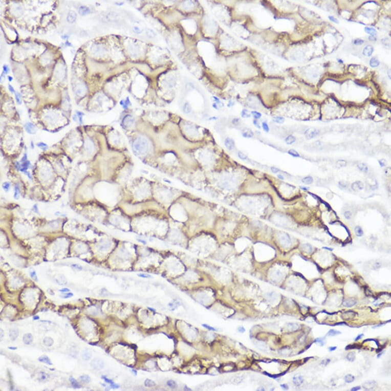 Immunohistochemistry - Anti-Aquaporin 1 Antibody (A89041) - Antibodies.com