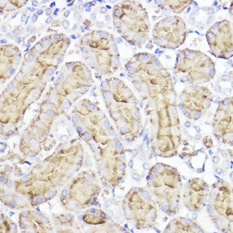 Immunohistochemistry - Anti-Aquaporin 1 Antibody (A89041) - Antibodies.com