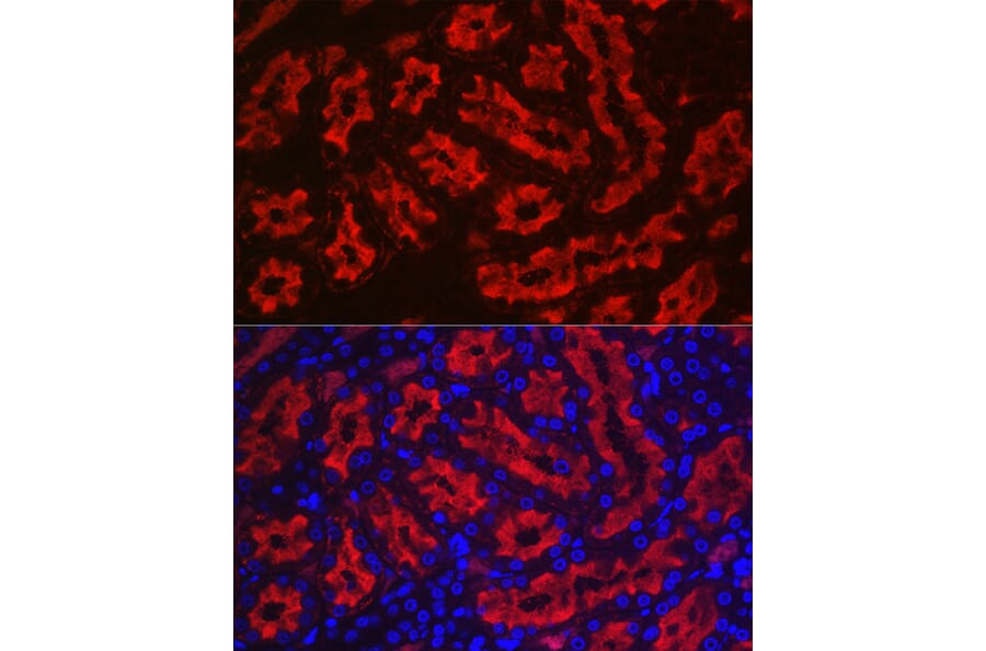 Immunofluorescence - Anti-Aquaporin 1 Antibody (A89041) - Antibodies.com