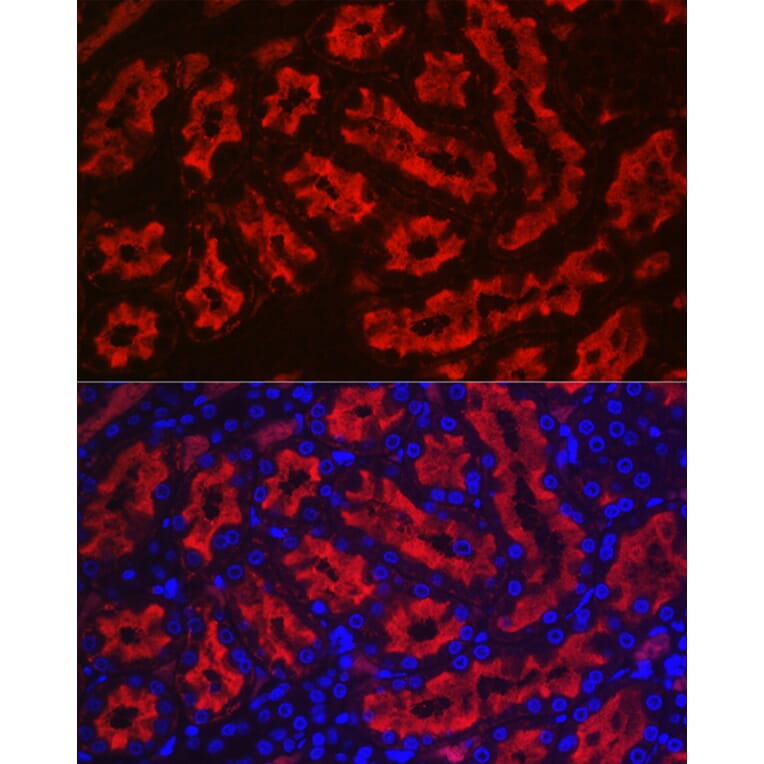 Immunofluorescence - Anti-Aquaporin 1 Antibody (A89041) - Antibodies.com