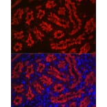 Immunofluorescence - Anti-Aquaporin 1 Antibody (A89041) - Antibodies.com