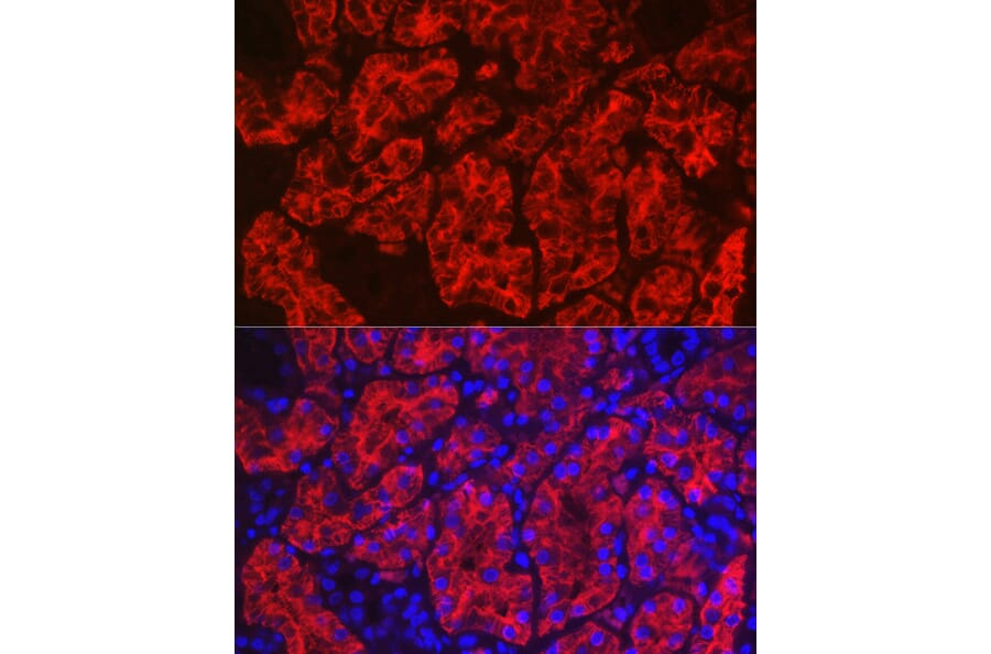 Immunofluorescence - Anti-Aquaporin 1 Antibody (A89041) - Antibodies.com