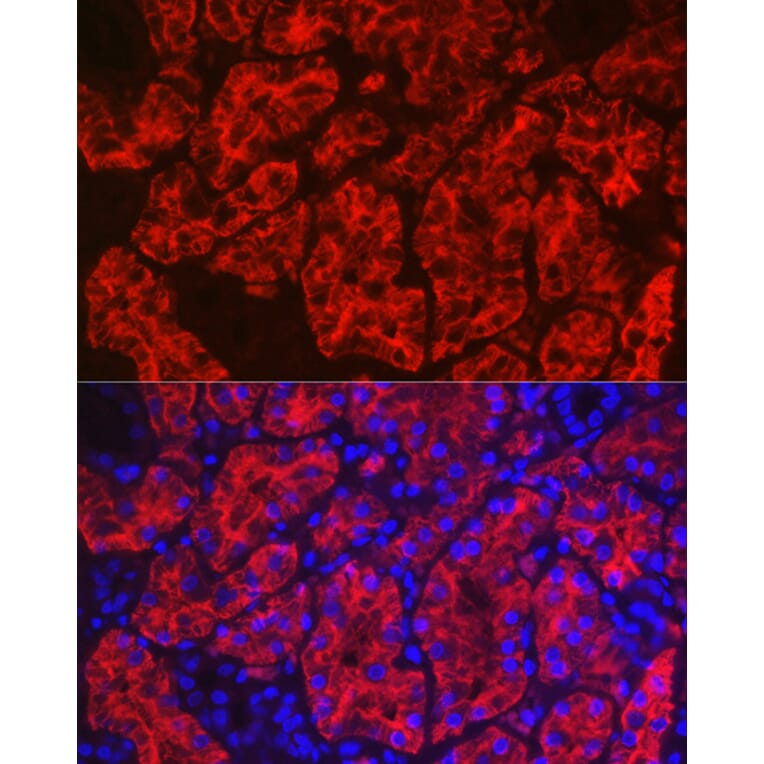 Immunofluorescence - Anti-Aquaporin 1 Antibody (A89041) - Antibodies.com