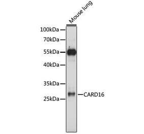 Western Blot - Anti-COP Antibody (A89042) - Antibodies.com