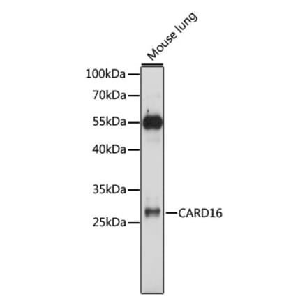 Western Blot - Anti-COP Antibody (A89042) - Antibodies.com