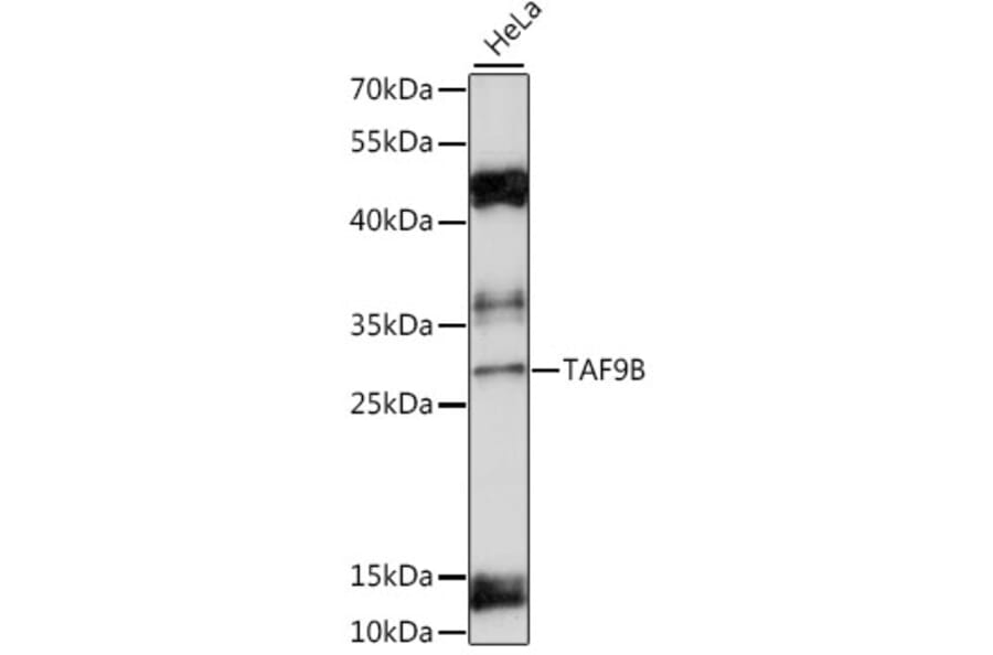 Western Blot - Anti-DN-7 Antibody (A89043) - Antibodies.com