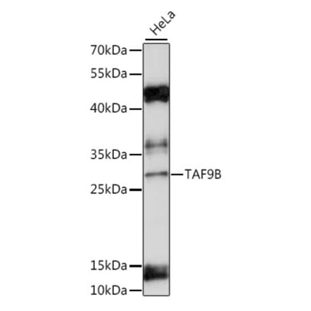 Western Blot - Anti-DN-7 Antibody (A89043) - Antibodies.com