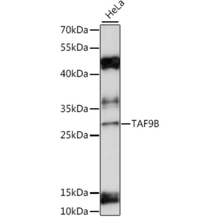 Western Blot - Anti-DN-7 Antibody (A89043) - Antibodies.com