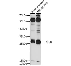 Western Blot - Anti-DN-7 Antibody (A89044) - Antibodies.com