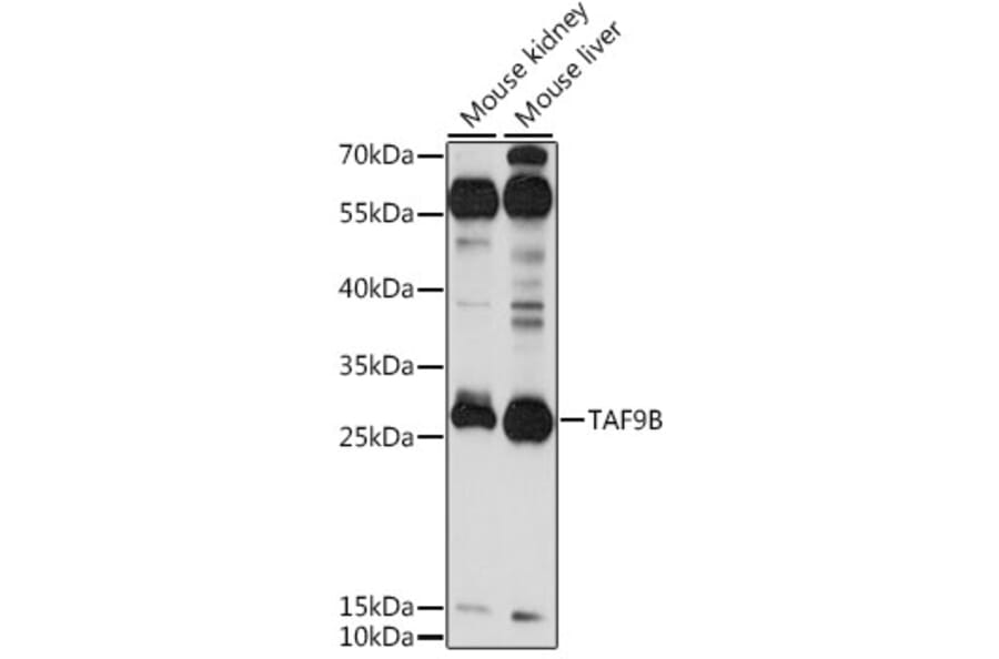 Western Blot - Anti-DN-7 Antibody (A89044) - Antibodies.com