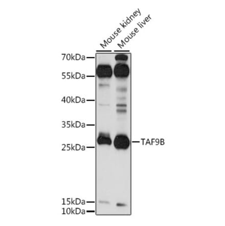 Western Blot - Anti-DN-7 Antibody (A89044) - Antibodies.com