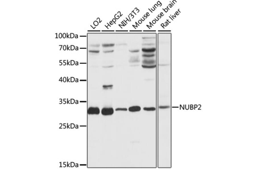 Western Blot - Anti-NUBP2 Antibody (A89046) - Antibodies.com