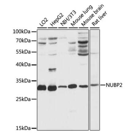 Western Blot - Anti-NUBP2 Antibody (A89046) - Antibodies.com