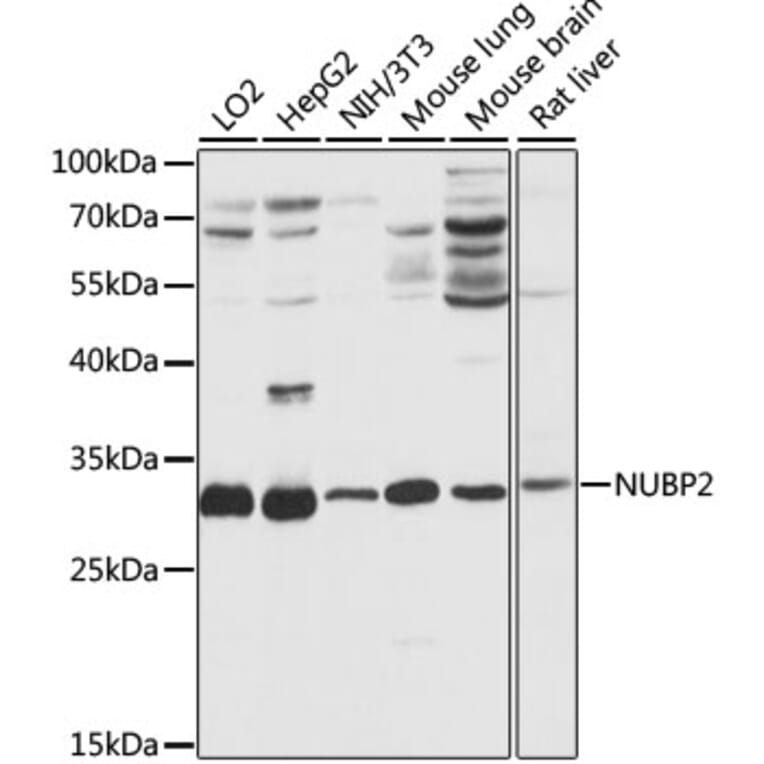 Western Blot - Anti-NUBP2 Antibody (A89046) - Antibodies.com