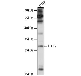 Western Blot - Anti-Kallikrein 12 Antibody (A89047) - Antibodies.com