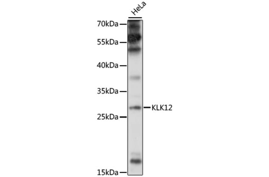 Western Blot - Anti-Kallikrein 12 Antibody (A89047) - Antibodies.com
