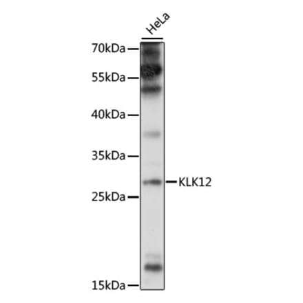 Western Blot - Anti-Kallikrein 12 Antibody (A89047) - Antibodies.com