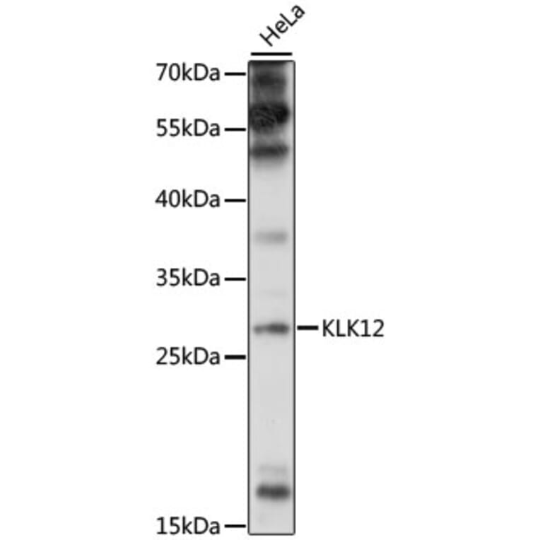 Western Blot - Anti-Kallikrein 12 Antibody (A89047) - Antibodies.com