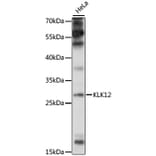 Western Blot - Anti-Kallikrein 12 Antibody (A89047) - Antibodies.com