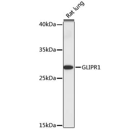 Western Blot - Anti-GLIPR1 Antibody (A89048) - Antibodies.com