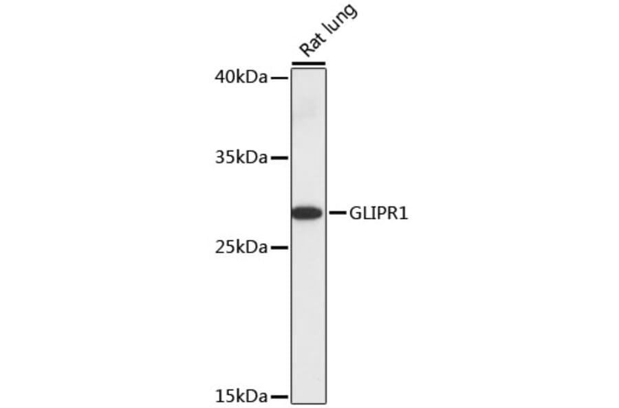 Western Blot - Anti-GLIPR1 Antibody (A89048) - Antibodies.com