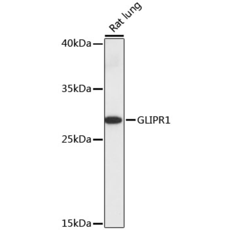 Western Blot - Anti-GLIPR1 Antibody (A89048) - Antibodies.com