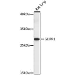 Western Blot - Anti-GLIPR1 Antibody (A89048) - Antibodies.com