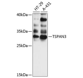 Western Blot - Anti-TSPAN3 Antibody (A89049) - Antibodies.com