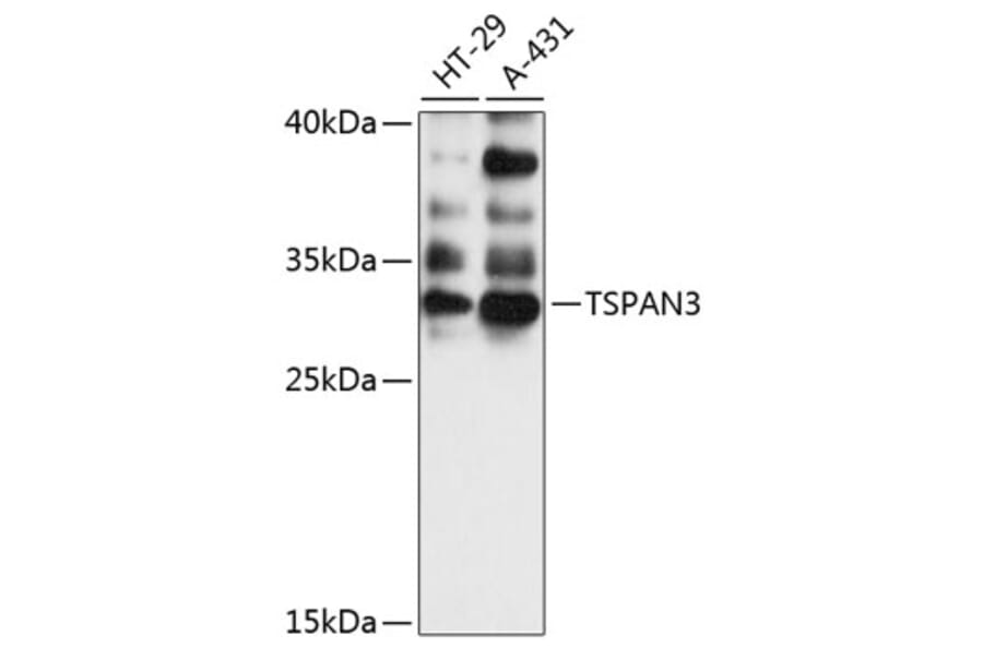 Western Blot - Anti-TSPAN3 Antibody (A89049) - Antibodies.com