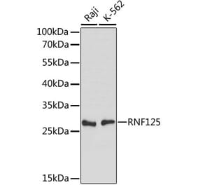 Western Blot - Anti-RNF125 Antibody (A89050) - Antibodies.com