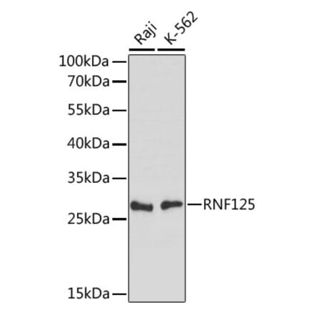 Western Blot - Anti-RNF125 Antibody (A89050) - Antibodies.com