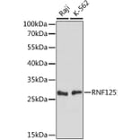Western Blot - Anti-RNF125 Antibody (A89050) - Antibodies.com