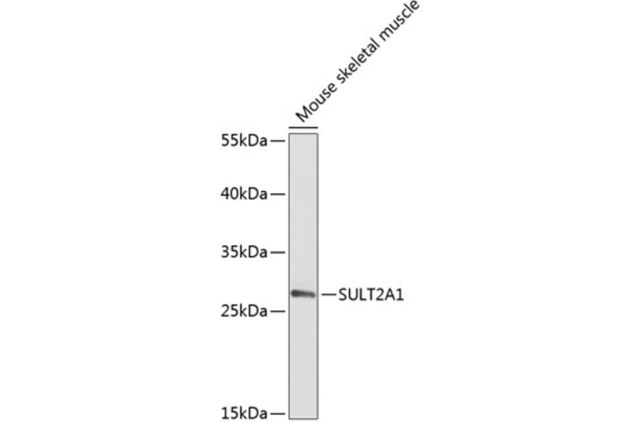 Western Blot - Anti-SULT2A1/ST2 Antibody (A89051) - Antibodies.com
