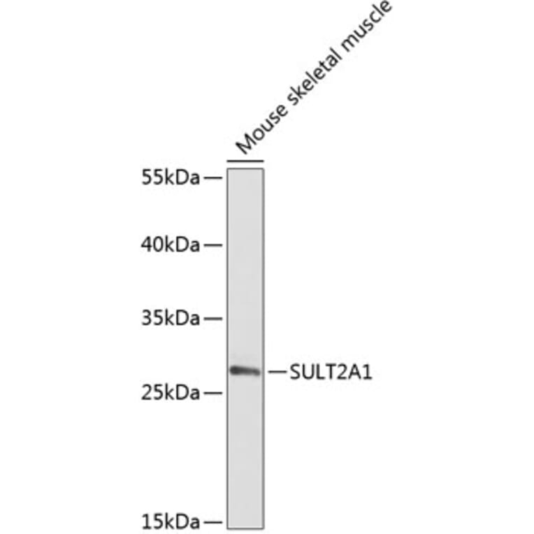 Western Blot - Anti-SULT2A1/ST2 Antibody (A89051) - Antibodies.com