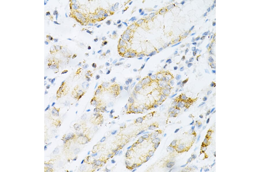 Immunohistochemistry - Anti-SULT2A1/ST2 Antibody (A89051) - Antibodies.com