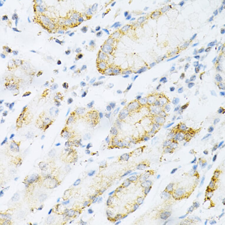 Immunohistochemistry - Anti-SULT2A1/ST2 Antibody (A89051) - Antibodies.com