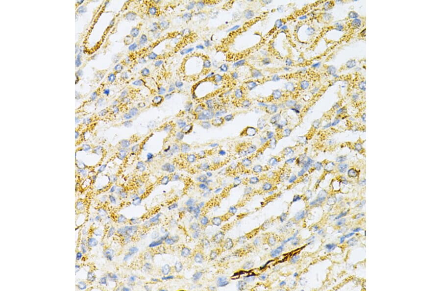 Immunohistochemistry - Anti-SULT2A1/ST2 Antibody (A89051) - Antibodies.com