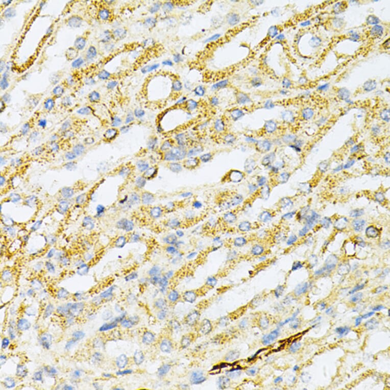 Immunohistochemistry - Anti-SULT2A1/ST2 Antibody (A89051) - Antibodies.com