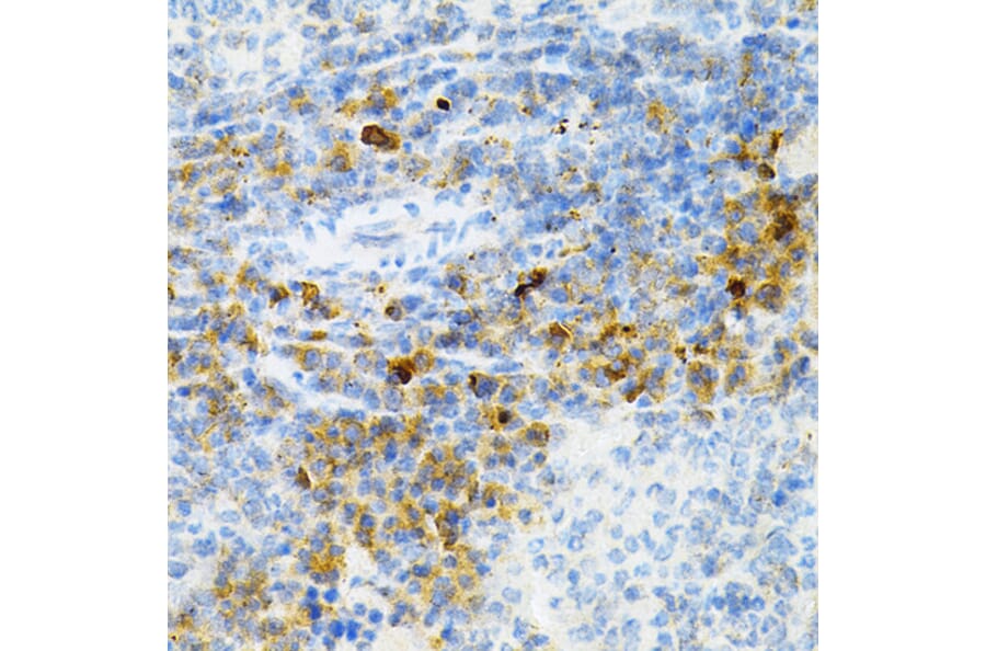 Immunohistochemistry - Anti-SULT2A1/ST2 Antibody (A89051) - Antibodies.com