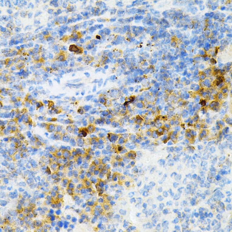 Immunohistochemistry - Anti-SULT2A1/ST2 Antibody (A89051) - Antibodies.com