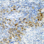 Immunohistochemistry - Anti-SULT2A1/ST2 Antibody (A89051) - Antibodies.com
