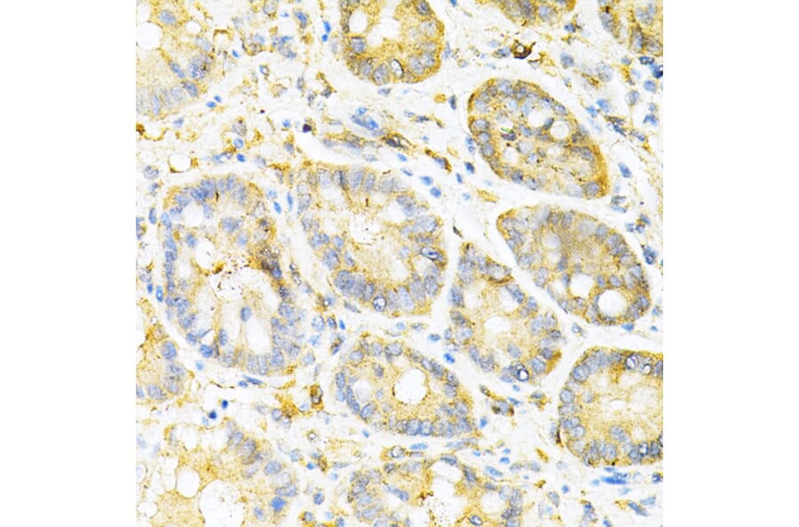 Immunohistochemistry - Anti-SULT2A1/ST2 Antibody (A89051) - Antibodies.com