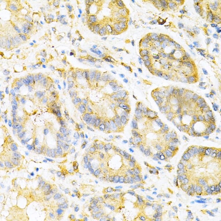 Immunohistochemistry - Anti-SULT2A1/ST2 Antibody (A89051) - Antibodies.com
