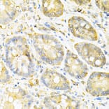 Immunohistochemistry - Anti-SULT2A1/ST2 Antibody (A89051) - Antibodies.com