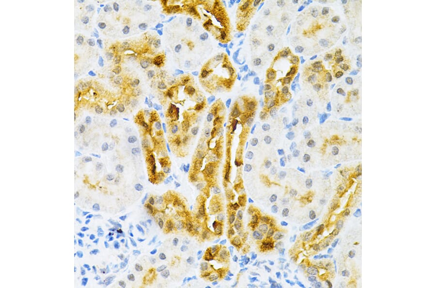 Immunohistochemistry - Anti-SULT2A1/ST2 Antibody (A89051) - Antibodies.com