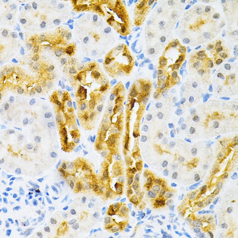 Immunohistochemistry - Anti-SULT2A1/ST2 Antibody (A89051) - Antibodies.com