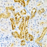 Immunohistochemistry - Anti-SULT2A1/ST2 Antibody (A89051) - Antibodies.com