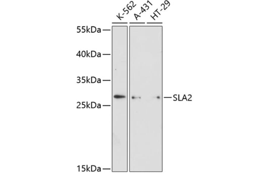 Western Blot - Anti-SLAP2 Antibody (A89052) - Antibodies.com